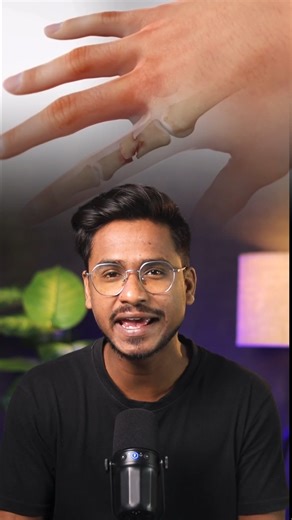 Chinese Scientists Create 'Bone Glue' That Repairs Fractures In Just 3 MinutesThe glue can also be naturally absorbed by the body as the bone heals, eliminating the need for another surgery to remove implants. #medical #glue #news #aniirban #AnirbanMondal #2GAM #gyangoppoandmore | Gyan Goppo and More