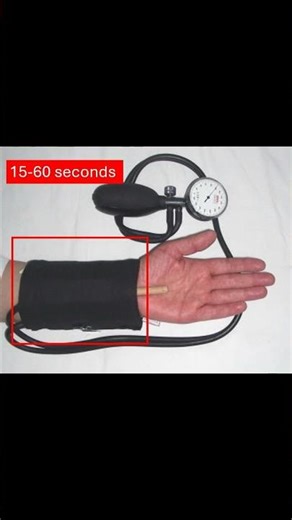 Gilliatt Tourniquet Test for Carpal Tunnel Explained | #handpain #meded #physiotherapy