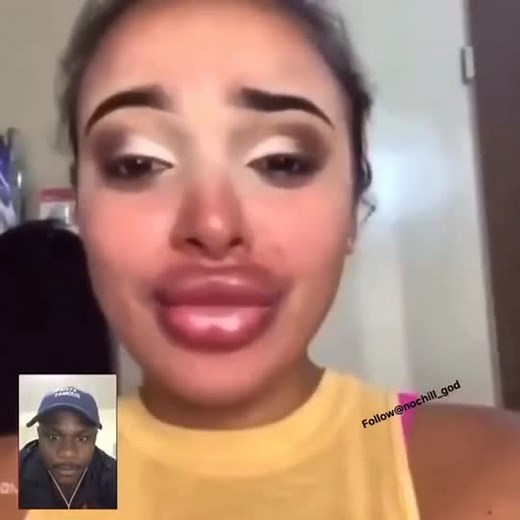 Surgery Gone Wrong: A Hilarious Mistake