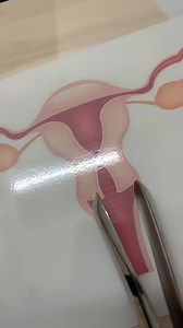 280K views · 2K reactions | https://seminardrecaah.com/pages/video-panduan-perancang-keluarga | Klinik PAKAR Aishah | Facebook