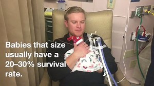 New parents Lacey and Wynne Breeden are thankful this holiday for the tiniest miracle. Their daughter Watson Jean Breeden was born at 25 weeks, nearly four months early. At just 11 ounces, she is the smallest baby ever born at Baylor Dallas. Babies that size usually have a 20 to 30 percent survival rate. Every day, Watson is beating the odds. FULL STORY ➨ http://bit.ly/2hamP0k | Baylor Scott & White Health