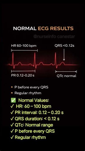 How do I read my ECG results?NORMAL ECG RESULTS