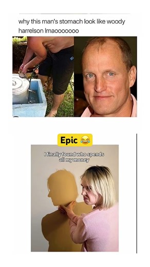 “Why this man’s stomach look like Woody Harrelson 😂” #funny​ #memes​ #usa​ #shorts​ #epic​ #comedy