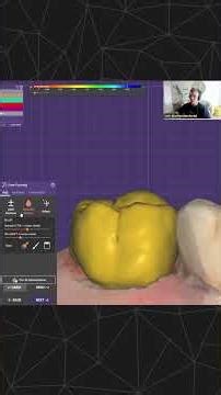 exocad Training Session - Seth Potter