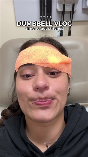 snitches usually get stitches, but I just dropped a dumbbell on my face instead 💀 here’s another update!