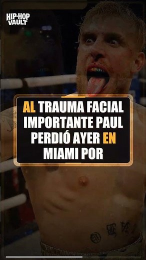 Jake Paul Debe Tomar Un Año Libre Después del Knockout, Dice el Médico #shorts