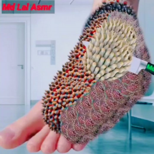 22K views · 119 reactions | Treatment and prevention of foot infections  #videos #safaivideo #doctorhelp #treatmentvideos #animationvideo | Md Lal Asmr | Facebook