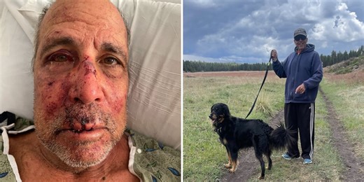 Strangers save man attacked while walking dog; Phoenix PD submit charges