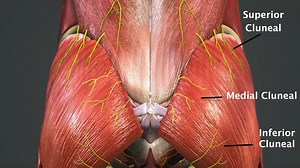 The Ultrasound Guided Superior Cluneal Nerve Block- Subscribe to PainExam or VPF for the Full Video