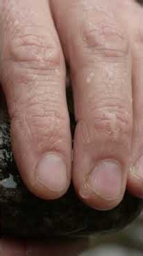 Title: Why Do Fingers Wrinkle in Water? The Science Explained