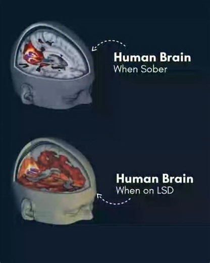 Abogacía LexEc on Instagram: "🧠 World-First Brain Scans Reveal How LSD Reshapes the Mind For the first time in history, scientists have captured detailed images of the human brain under LSD, uncovering how this powerful psychedelic transforms perception and consciousness itself. Researchers at Imperial College London, working with the Beckley Foundation, administered controlled doses of LSD to 20 healthy volunteers and used fMRI and MEG scans to map their brain activity. The results were astoni
