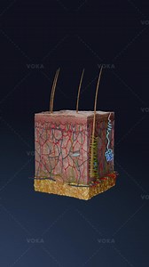 10K views · 61 reactions | What are vascular non-inflammatory...