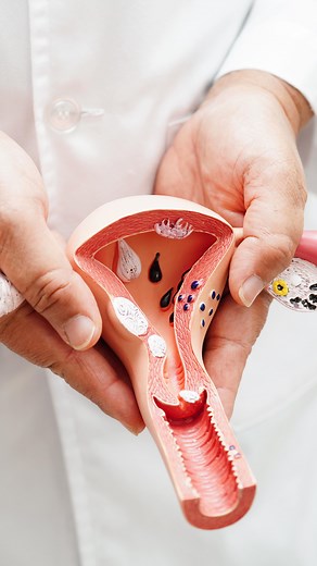 Kolor krwi miesiączkowej bardzo wiele mówi o Twoim zdrowiu 🩸 Jak się okazuje nie każde zabarwienie jest prawidłowe. Odpowiednie rozpoznanie barwy może zapobiec wielu problemom zdrowotnym i szybko wykryć niepokojące sygnały☝🏻 Sprawdź co oznacza konkretny kolor i kiedy warto zgłosić się na wizytę u lekarza ginekologa. Na wizytę w centrum medycznym Doctorpro można się umówić: 📲 przez Direct: @doctorpro.pl 📞 telefonicznie: 800 003 033 💻 za pomocą formularza na stronie www (link w nagłówku profi