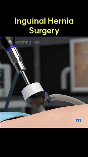 Inguinal Hernia Surgery