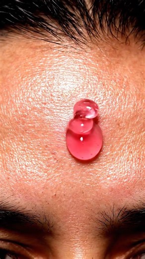 Why Is Pink Gel Used on Forehead Skin? #satisfying