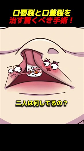 口唇裂と口蓋裂を治す驚くべき手術！