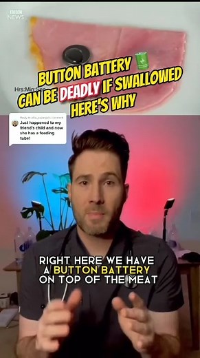 20K views · 267 reactions | swallowed button battery can be deadly and burn your esophagus. #emergencymedicine #firsttimemom #firsttimeparent #doctor | Doctor Joe | Facebook