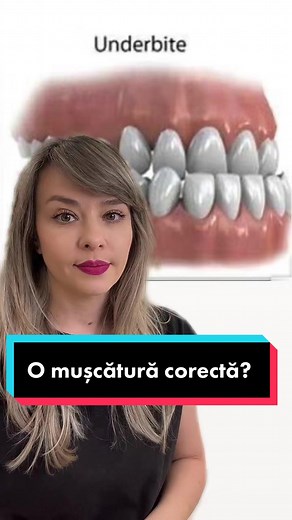 Obțineți o mușcătură corectă!