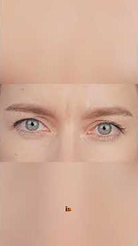 Top 10 Genetic Anomalies Ever Recorded