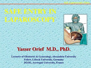 PPT - SAFE ENTRY IN LAPAROSCOPY PowerPoint Presentation, free download - ID:2208525
