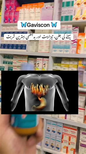 Gaviscon Antacid: Relief from Heartburn and Indigestion