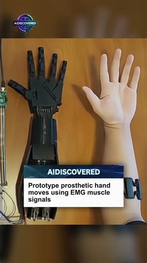 Control a robotic hand with your forearm #Robotics #AssistiveTech #3DPrinting