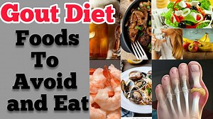 GOUT Diet: Foods to Avoid and Eat By Doc Willie Ong Find out the Explanation | Doc Willie Ong