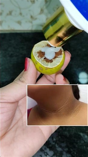 Do this to get rid of neck blackness/neck black/beauty tips