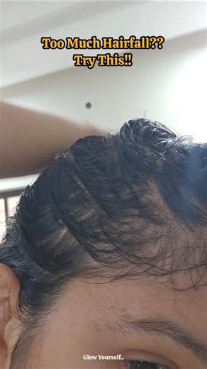 Try this One Powerful Remedy to Regrow Hair✨️Glow Yourself🌸