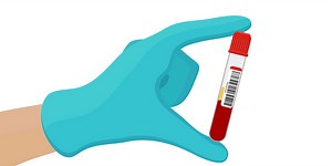 The Top 6 Essential Blood Biomarkers for Optimal Health