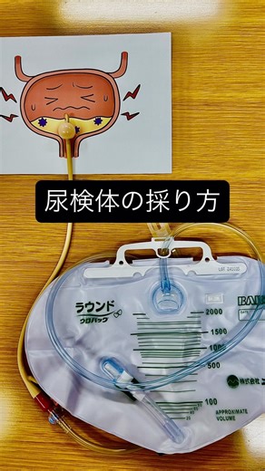 ICNたまよ on Instagram: "膀胱留置カテーテルを留置している時の尿検体の採り方について、注意点をまとめました。 #感染管理認定看護師 #膀胱留置カテーテル #尿検体"