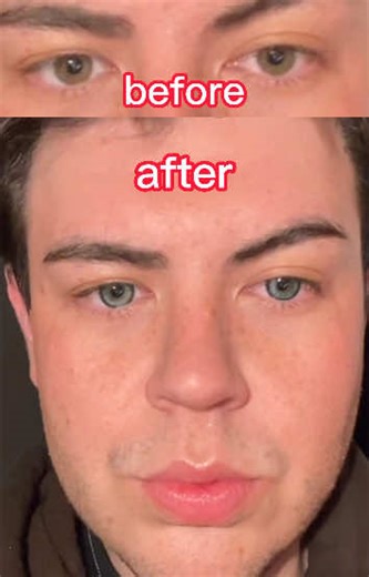 Discover Unicoeye Colored Contacts for Stunning Eyes