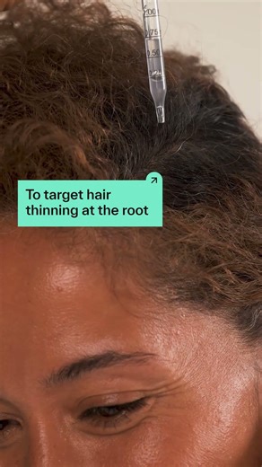 Dermatica's New Hair Loss Service