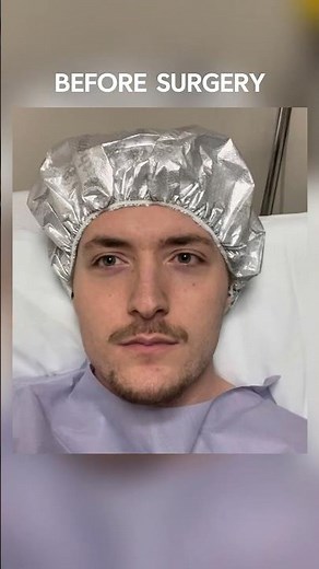 Jaw Surgery Recovery Day 1-7 (Sleep Apnea)