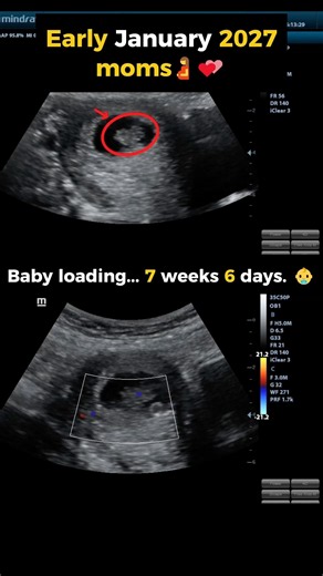 Team january we are 7-8 weeks now | #baby #ultrasound #weekspregnant