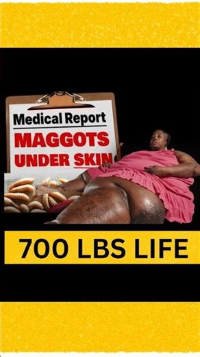 Lisa Fleming Extreme Weight Story #shortsfeed #trending #viral #fact