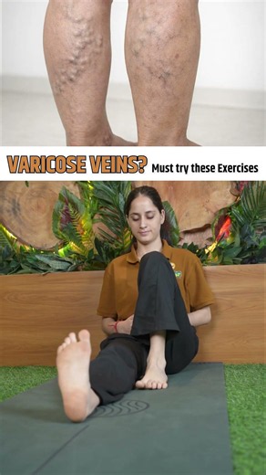 Exercises for Varicose Veins | Leg Mobility, Swelling & Circulation Support | HiiMS