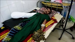 Bangladesh's 'Tree Man' Undergoes Successful Surgery |
