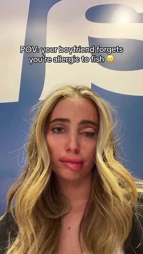 Fish Allergy Prank on Girlfriend - Allergic Reaction Comedy