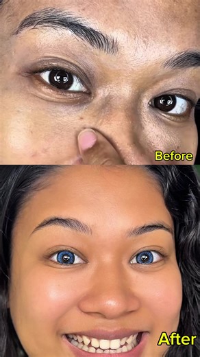 Natural Freshness with Aloe Herbal Under Eye Serum