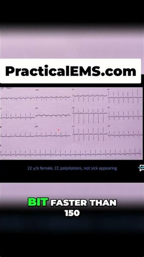 EKG Decoding: From Palpitations to Heart Attacks - Doctor Reveals All! #shorts