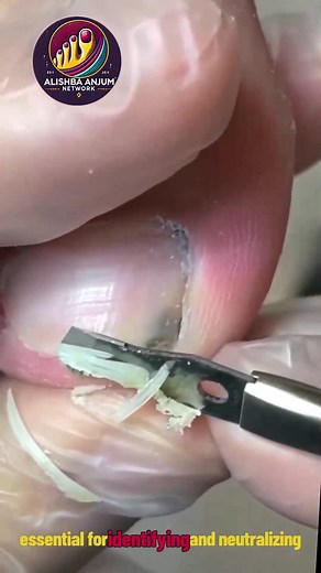 Easy ingrown nail routines for simple daily support 🍎🍅 #ToenailRoutine #CleanNailsDaily #HealthyNails | Alishba Anjum vlog