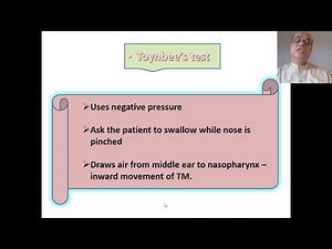 Tests for Eustachian Tube patency, Valsalva manoeuvre, Toynbee's test