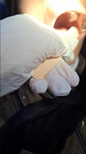 Smear (exfoliative cytology) biopsy of the left buccal mucosa