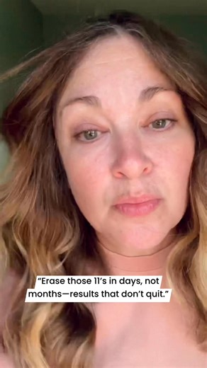 1.1K views · 15 reactions | Ok bestie… those little 11’s between my brows? GONE.  No needles, no filter…just smooth skin that actually stays that way. I’m obsessed! Want the scoop? Drop a  or ‘INFO’ below and I’ll spill all the details! #skingoals #over50beauty #realresults #glowgirl #NoFilterConfidence #matureskin #holisticskincareproducts #antiaging #skinhealth | Kishli Rhone Ashley | Facebook