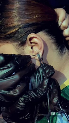 2 A.M. Booking! Middle and Upper Lobe for Ma’am! Thank you so much for trusting Sir Ace Body Piercing! 🥰 #Piercing #Piercings #Lobe #Helix #Conch #Tragus #Industrial #Rook #Snug #Daith #ForwardHelix #AntiTragus #Orbital #Auricle #Nostril #HighNostril #Septum #VerticalTip #Bridge #Septril #Nasallang #Labret #Monroe #Medusa #VerticalLabret #Jestrum #Dahlia #CyberBites #AngelBites #DolphinBites #SpiderBites #SnakeBites #SharkBites