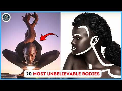 20 People You Won’t Believe Exist: The Most Extreme Body Anomalies 2026