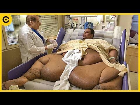 Can You Guess His Weight? Most Overweight People in the World