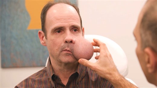 140K views · 1.9K reactions | 'About Face,' premiering Oct. 29 on TLC, spotlights a team of LA-based plastic surgeons, taking on complex facial reconstruction cases. | Entertainment Tonight | Facebook