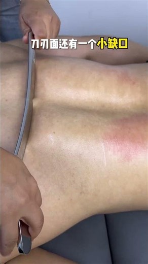 疏通筋膜一步到位丝滑打磨的筋膜刀就是这么好用！弧度贴合人体线条！#按摩 #熱門 #筋膜刀 #筋膜刀放鬆 #刮痧